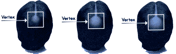 (Vertex)̎ʐ^